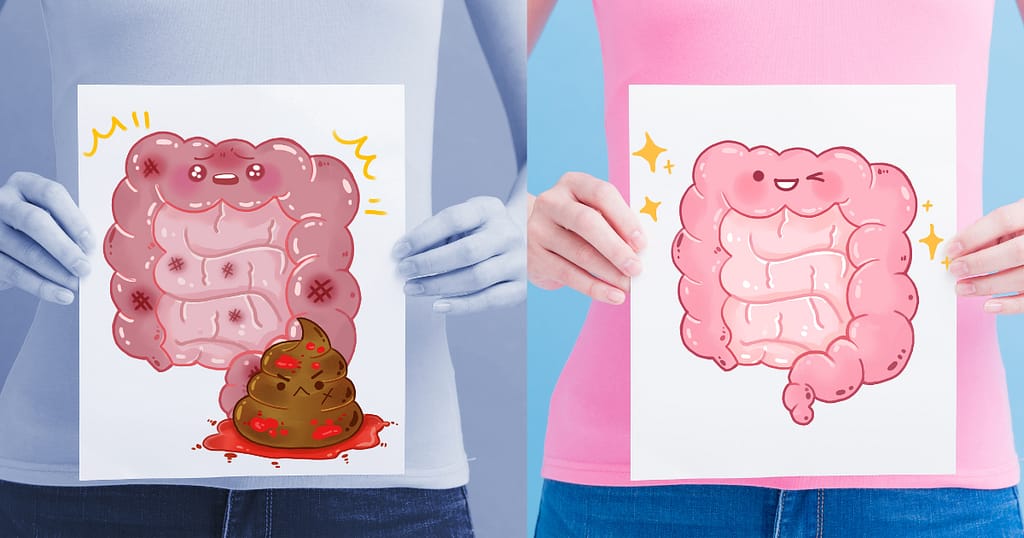 Health Sub-Niches- A picture comparing a healthy digestive system and unhealthy one