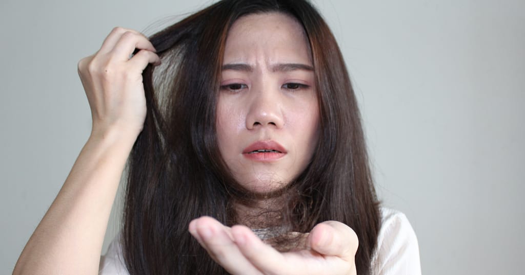 Health Sub-Niches- A Picture of a Woman Experiencing Hair Loss